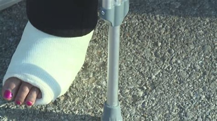 Arizona Woman Breaks Ankle