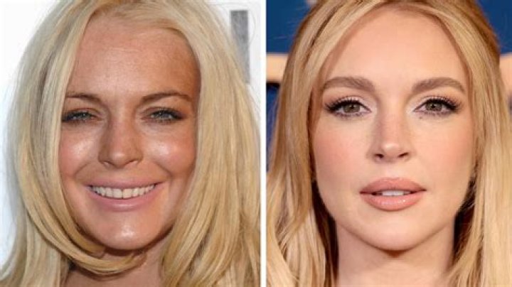 Before & After Face Photos – Hollywood Life