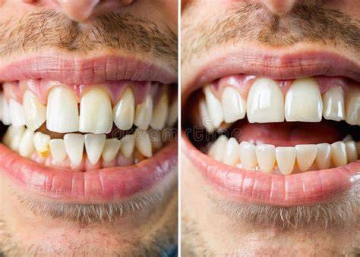 before-and-after