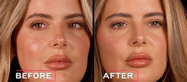Brielle Biermann Talks Plastic Surgery: I’ll Probably ‘Redo My Whole Body’ One Day