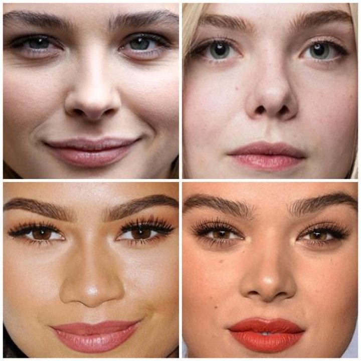 Chloe Moretz Lip Injections
