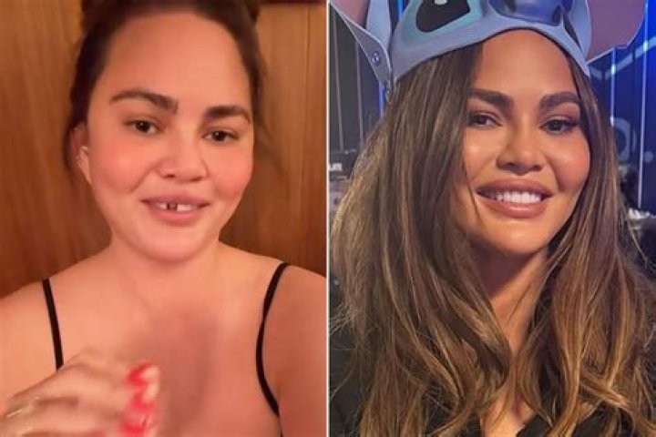 Chrissy Teigen After &lsquo;Fallon&rsquo;