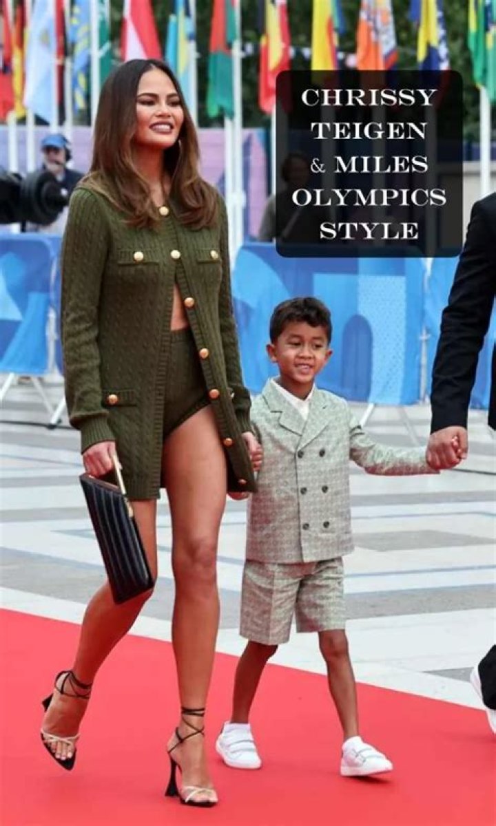 chrissy teigen son miles flat head