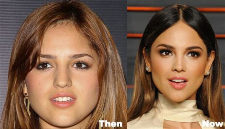 Eiza Gonzalez Plastic Surgery
