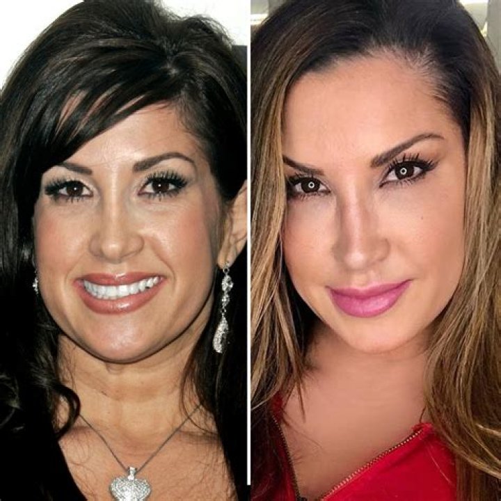 Jacqueline Laurita Plastic Surgery