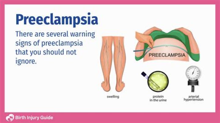 jessica simpson preeclampsia risk