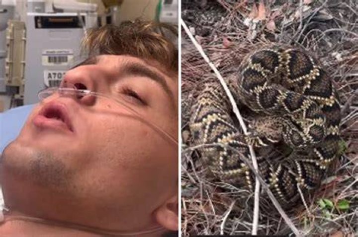 Jon Gosselin Is Hospitalized After Being Bit By Venomous Spider: ‘I Was In Excruciating Pain’