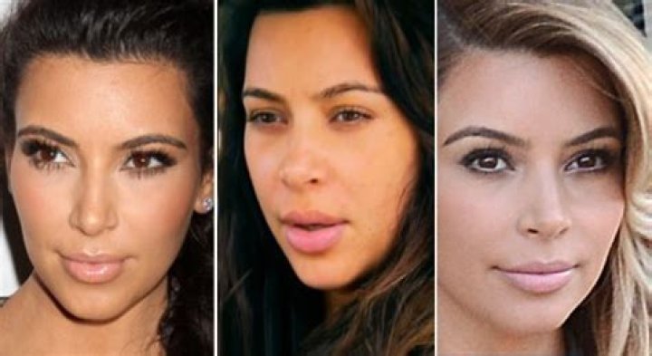 Kardashians’ Lips: Bruce Jenner & More Before & After Photos