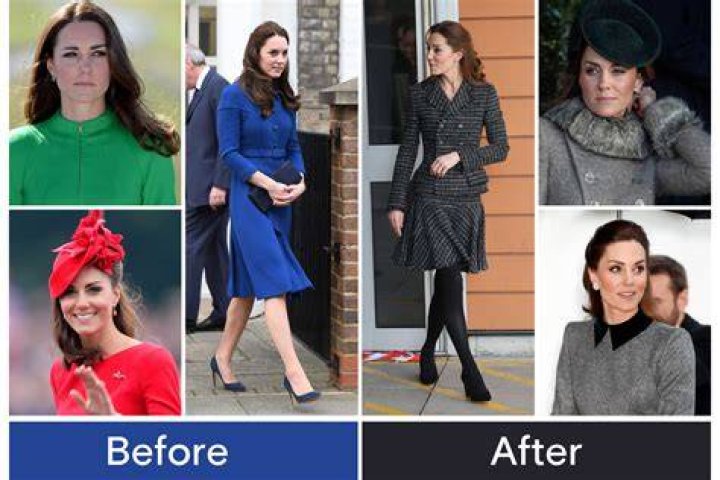 Kate Middleton C-Section