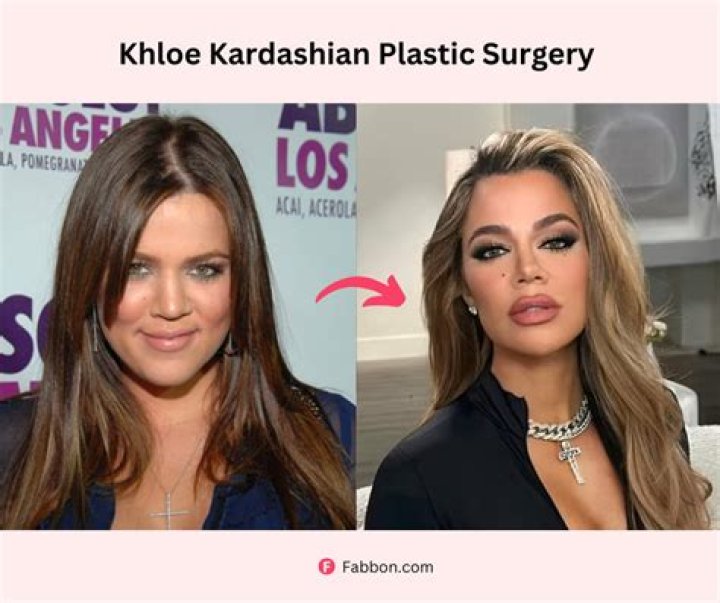 Khloe Kardashian: Plastic Surgeon Speaks On Appearance After Fans Think She Had A Nose Job