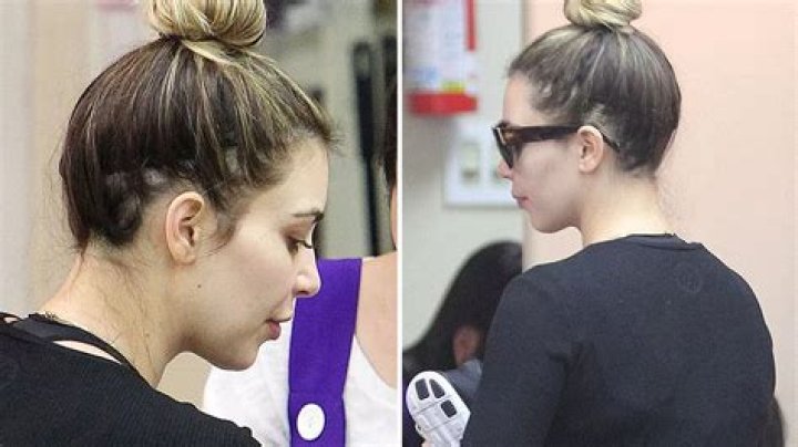 Kim Kardashian Hair Loss
