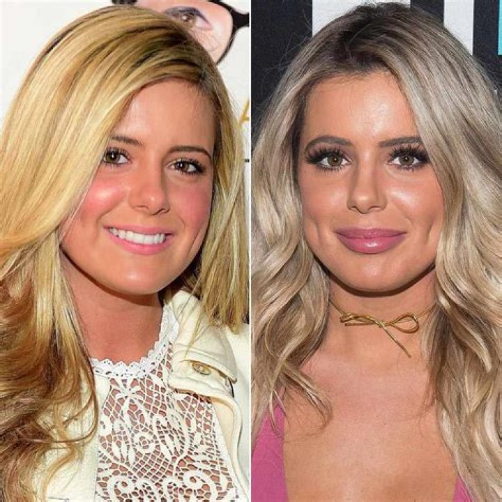 Kim Zolciak Brielle Biermann Plastic Surgery
