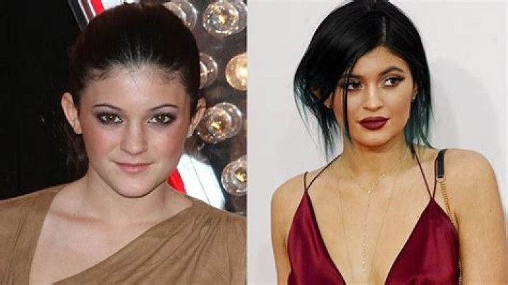 Kylie Jenner Before