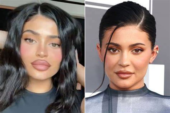 Kylie Jenner Big Lips