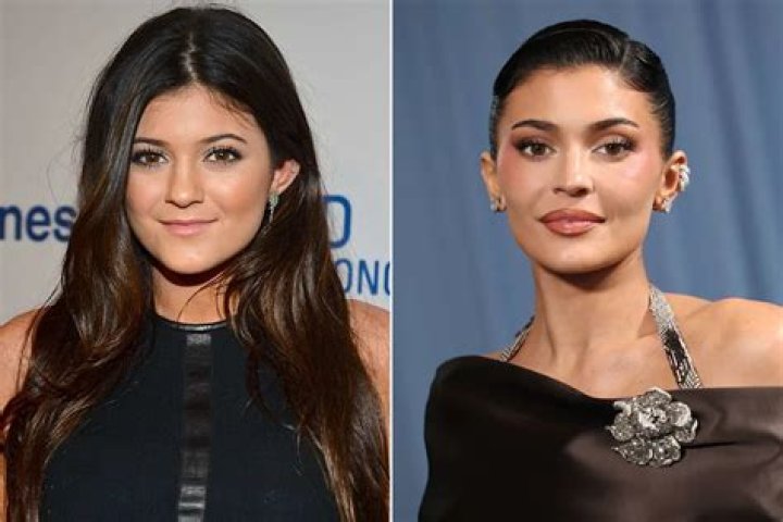 Kylie Jenner Plastic Surgery Reason — Why She Had 6 Procedures Done – Hollywood Life