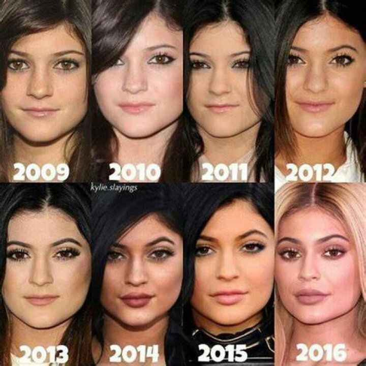 Kylie Jenner Transformation