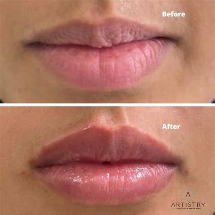 lip