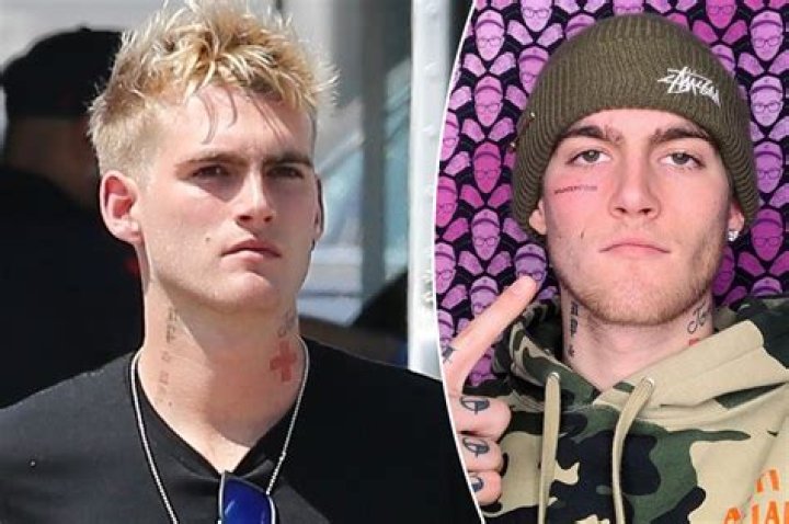 Presley Gerber Seemingly Has ‘Misunderstood’ Face Tattoo Removed – Hollywood Life