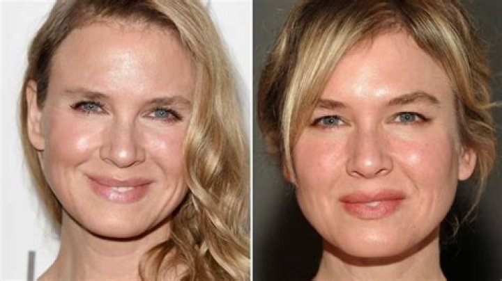 Renee Zellweger Before Plastic Surgery — What Her Face Looked Like In High School – Hollywood Life