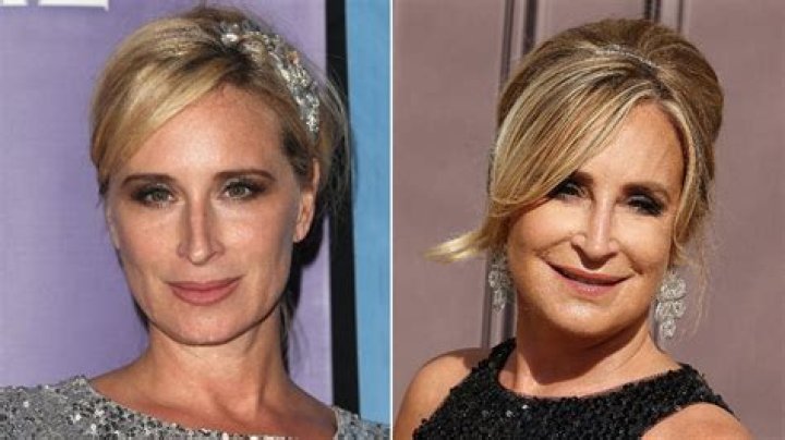‘RHONY’s Sonja Morgan Gets Nose Job To ‘Straighten & Lift’ It — See Before & After Pics Of Her New Look