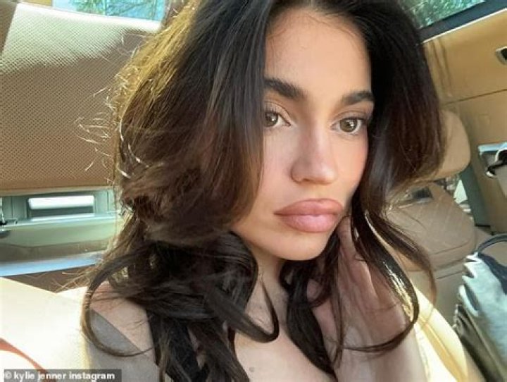See Her Kylie Jenner-Inspired Pout – Hollywood Life