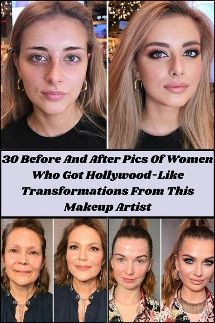See Photos Of Shocking Transformations – Hollywood Life