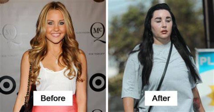 See Their Transformations In Photos – Hollywood Life