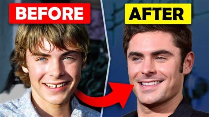 See Transformation Photos – Hollywood Life