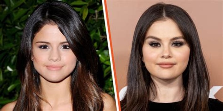 Selena Gomez Looks Back on Her Body Transformation in Swimsuit Photos: ‘Sometimes I Forget It’s OK to Be Me’