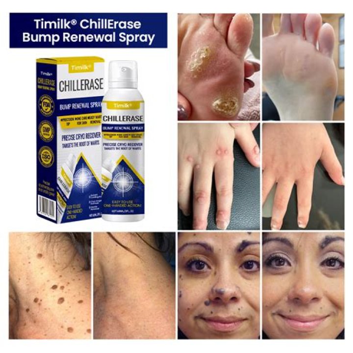 skin spray