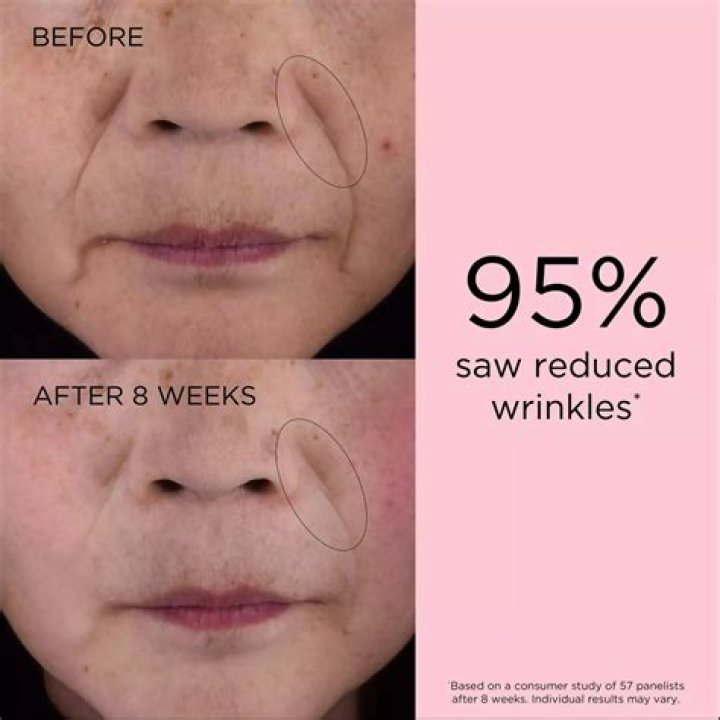 Smooth, Wrinkle-Free Skin Is Possible With These Gentle Yet Effective Retinol Serums