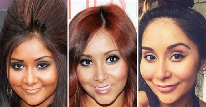 Snooki plastic surgery