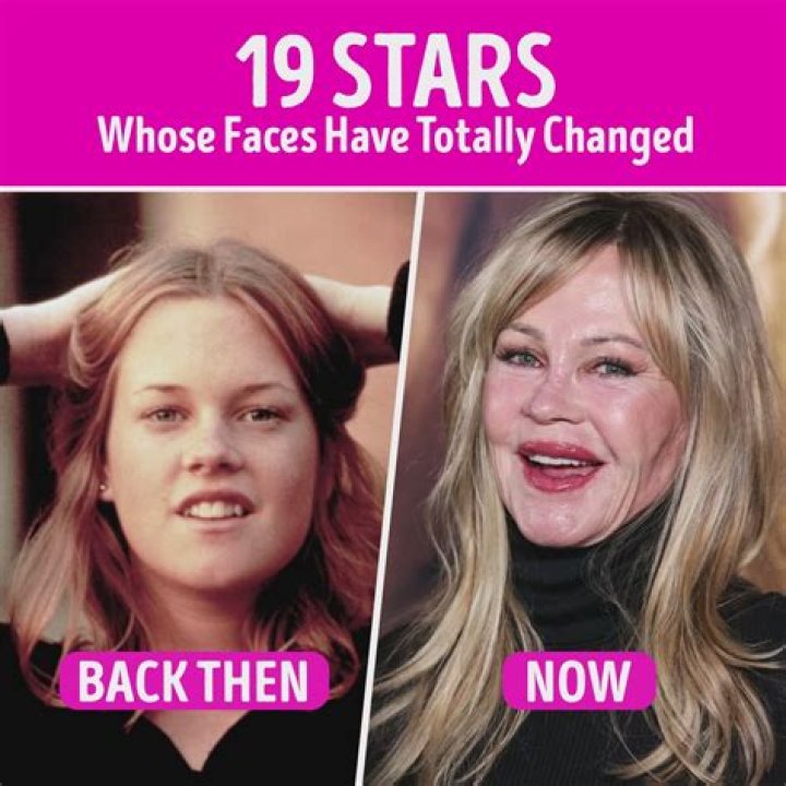Stars Whose Faces Changed