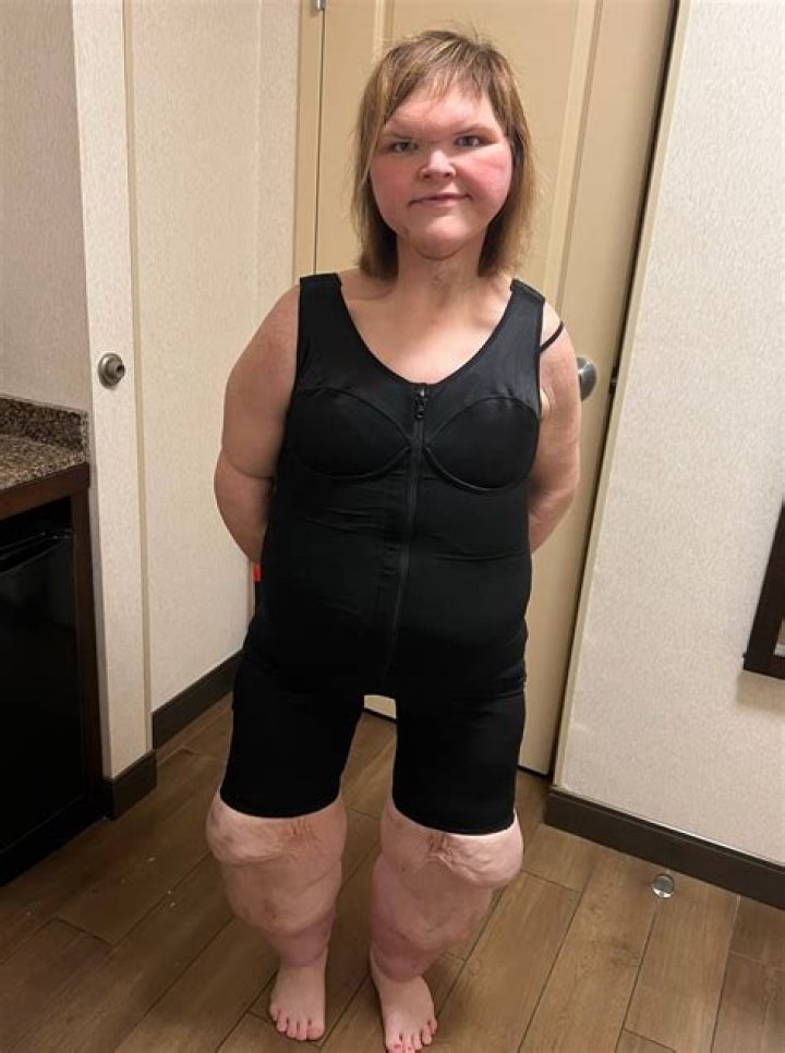 tammy weight loss