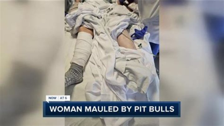 VA Woman, 22, Mauled to Death By Her Pit Bulls — Why It Could Have Happened: Expert Speaks