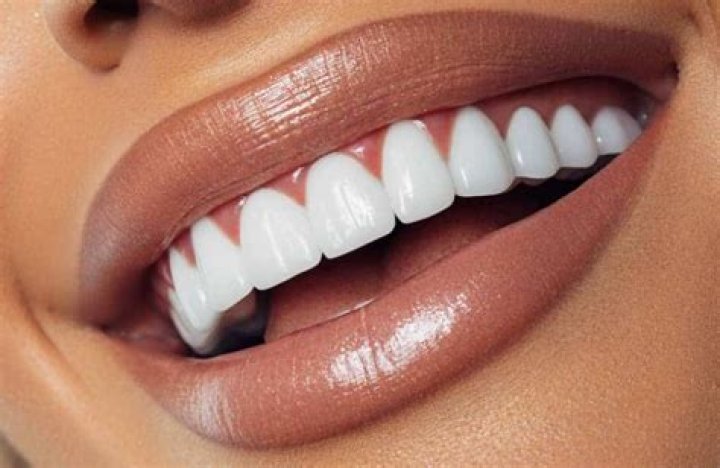 white teeth