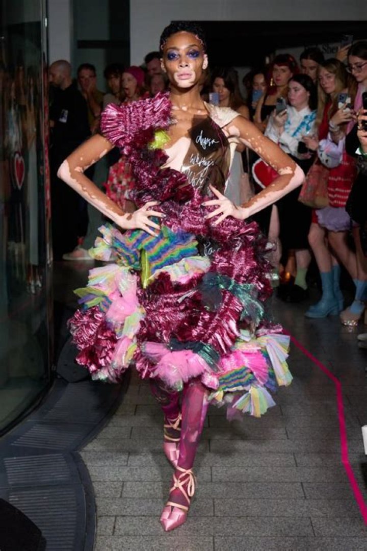Winnie Harlow For Moschino x H&M