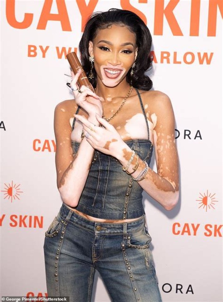 Winnie Harlow&rsquo;s Cay Skin