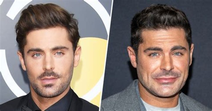 Zac Efron Broke Jaw